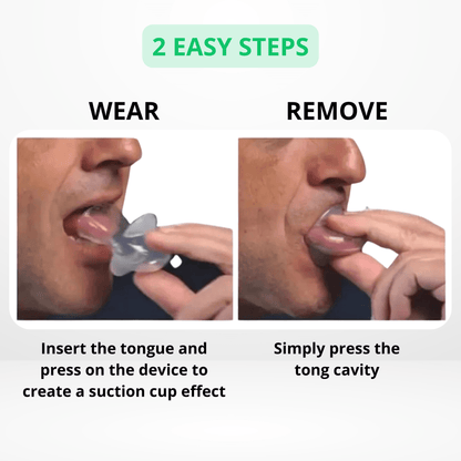 Anti-Snoring Tongue Retainer - Stop Snoring Instantly - Snorestop PRO